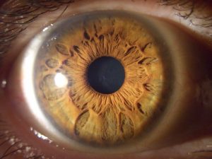 muestra cuarta de un iris